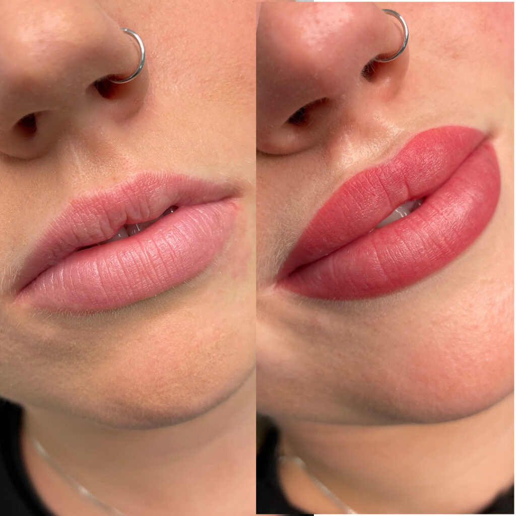mooie-lippen-1024x1024